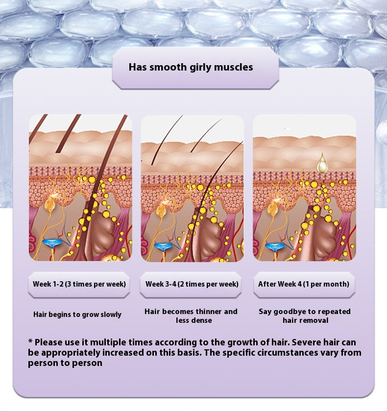 Laser Freezing Hair Removal Device